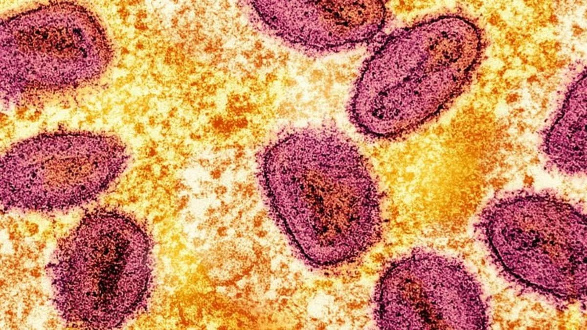 Colorized Reuters-NIAID micrograph showing mpox virus particles inside an infected cell